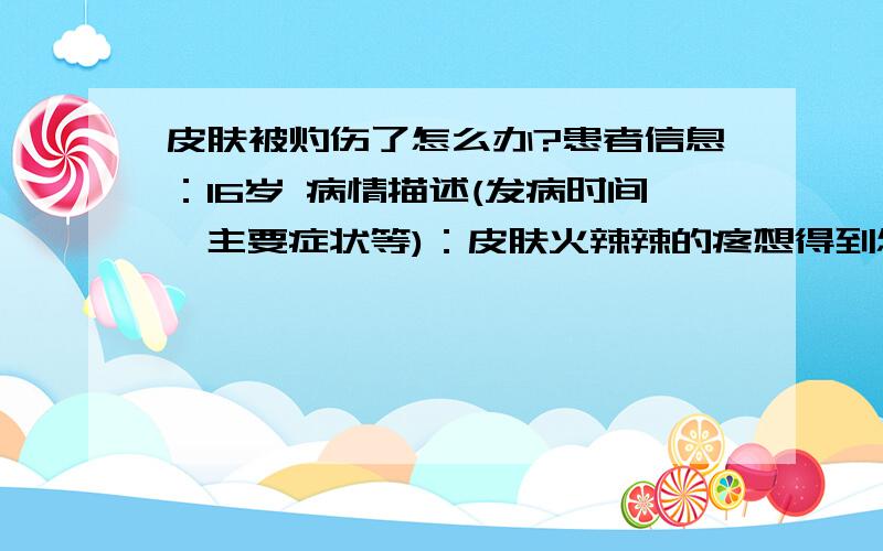 皮肤被灼伤了怎么办?患者信息：16岁 病情描述(发病时间、主要症状等)：皮肤火辣辣的疼想得到怎样的帮助：怎样治疗曾经治疗