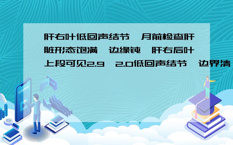 肝右叶低回声结节一月前检查肝脏形态饱满,边缘钝,肝右后叶上段可见2.9*2.0低回声结节,边界清,CDFI未见血流信号.