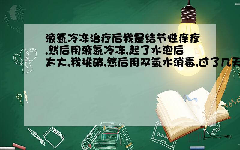 液氮冷冻治疗后我是结节性痒疹,然后用液氮冷冻,起了水泡后太大,我挑破,然后用双氧水消毒,过了几天,没见好,把上面的皮撕掉