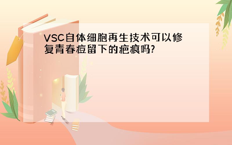 VSC自体细胞再生技术可以修复青春痘留下的疤痕吗?