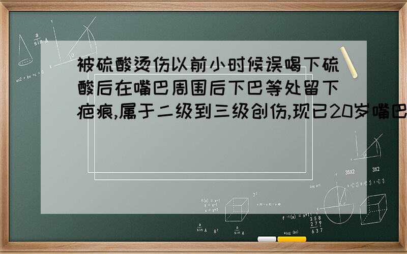 被硫酸烫伤以前小时候误喝下硫酸后在嘴巴周围后下巴等处留下疤痕,属于二级到三级创伤,现已20岁嘴巴周围创伤已不是特别明显但