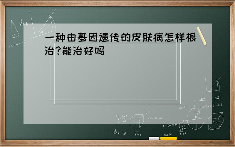 一种由基因遗传的皮肤病怎样根治?能治好吗