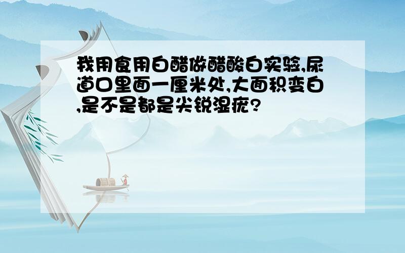 我用食用白醋做醋酸白实验,尿道口里面一厘米处,大面积变白,是不是都是尖锐湿疣?