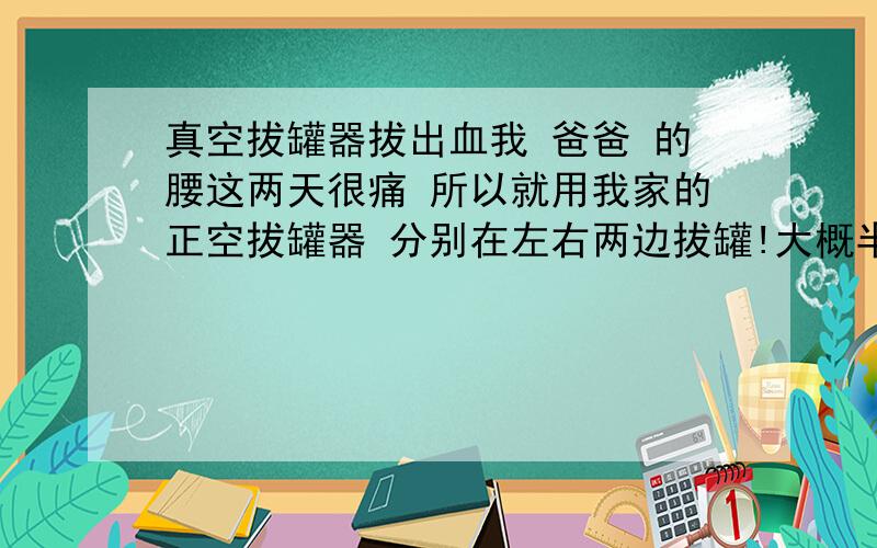 真空拔罐器拔出血我 爸爸 的腰这两天很痛 所以就用我家的正空拔罐器 分别在左右两边拔罐!大概半个小时左右的时候就去啦!可