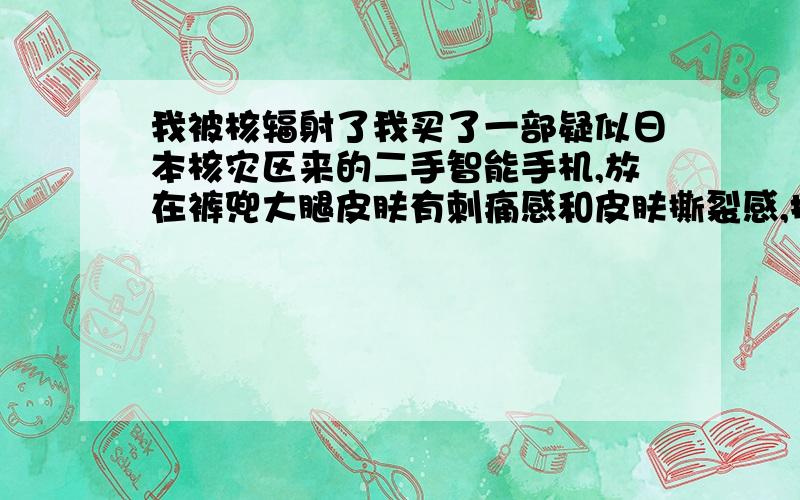 我被核辐射了我买了一部疑似日本核灾区来的二手智能手机,放在裤兜大腿皮肤有刺痛感和皮肤撕裂感,把手机放在别的手机旁边,别的