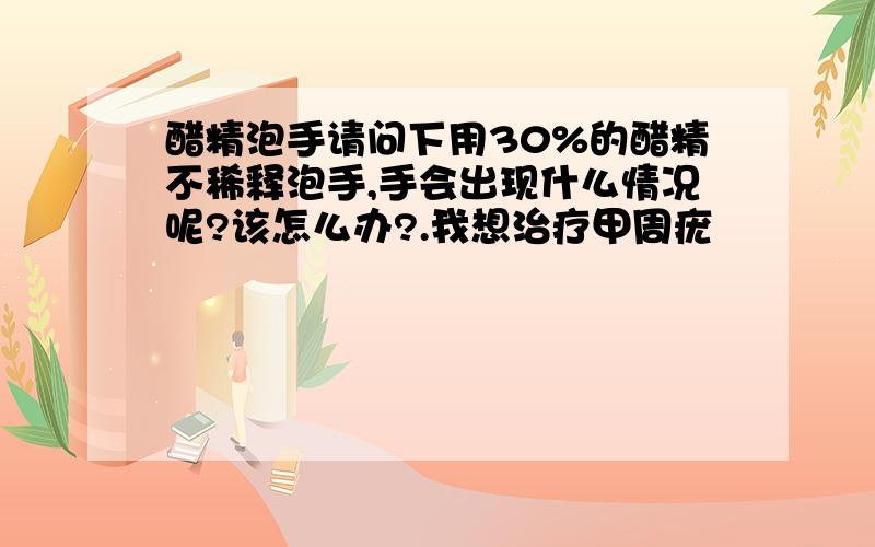 醋精泡手请问下用30%的醋精不稀释泡手,手会出现什么情况呢?该怎么办?.我想治疗甲周疣